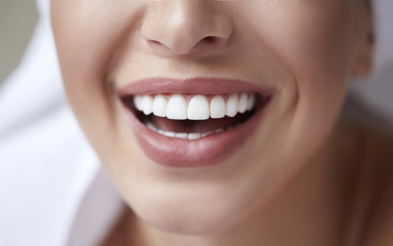 Chăm sóc răng sau khi tẩy trắng như thế nào để duy trì màu răng?