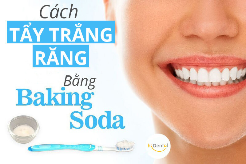 Tẩy trắng răng bằng baking soda