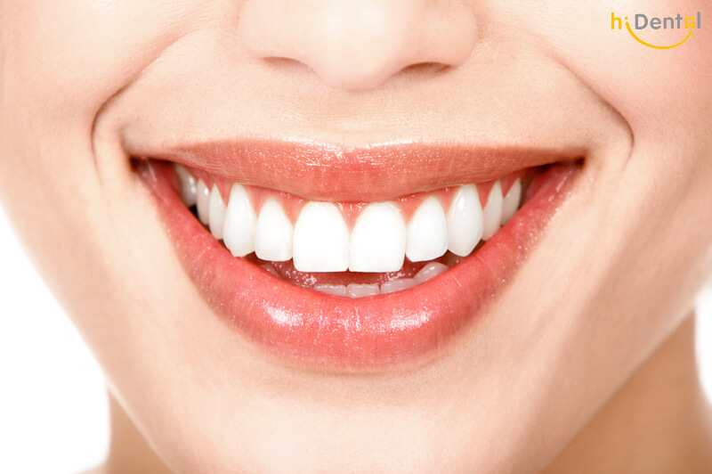 Tẩy trắng răng có ảnh hưởng gì không