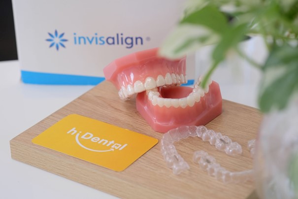 Quy Trình Niềng Răng Invisalign