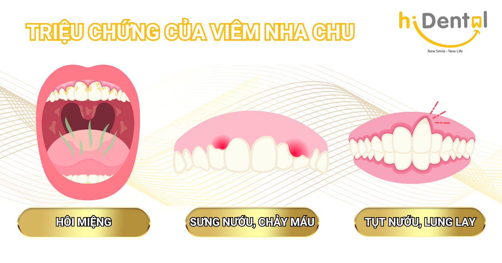 Viêm Nha Chu và Những Hậu Quả Khôn Lường