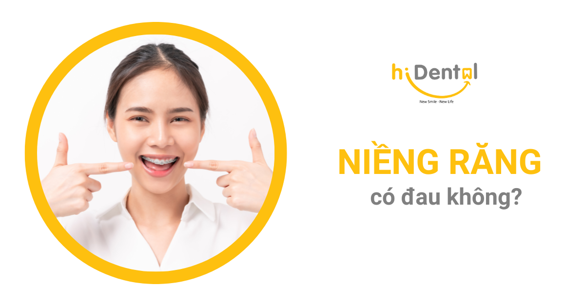 Niềng răng có đau không là câu hỏi nhiều khách hàng băn khoăn