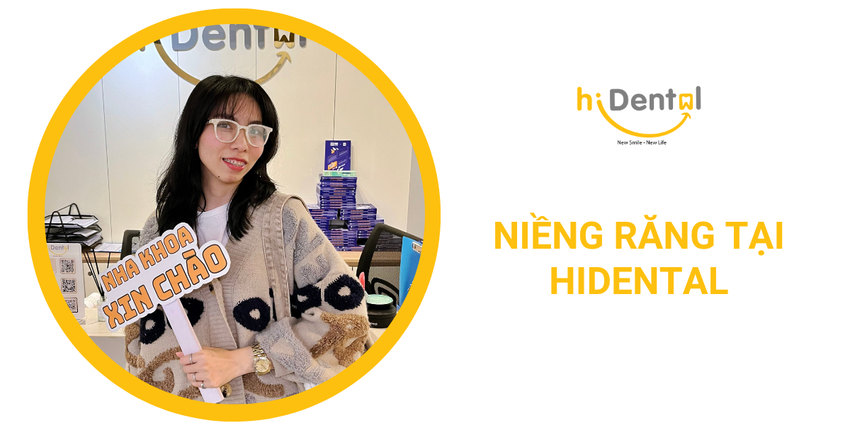 Niềng răng là phương pháp được nhiều khách hàng lựa chọn