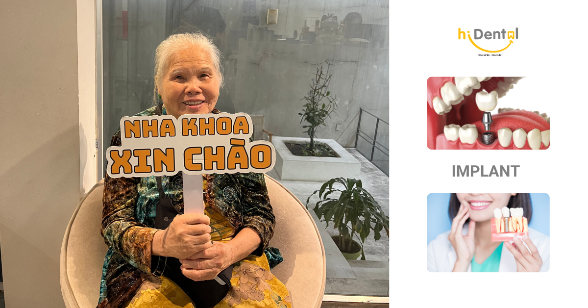 hiDental có quy trình trồng răng implant đảm bảo tiêu chuẩn quốc tế với công nghệ cao