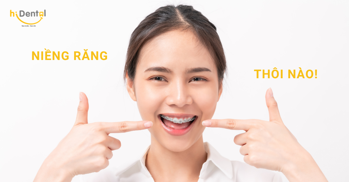 Niềng răng mắc cài là kỹ thuật chỉnh nha được nhiều khách hàng tin dùng