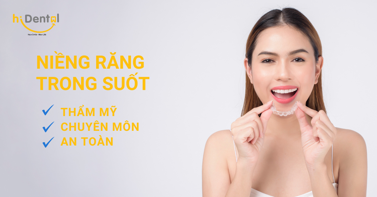 Niềng răng trong suốt là phương pháp thẩm mỹ được ưa chuộng